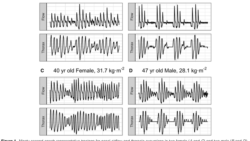 Sex-related Differences in Loop Gain during High-Altitude Sleep-disordered Breathing