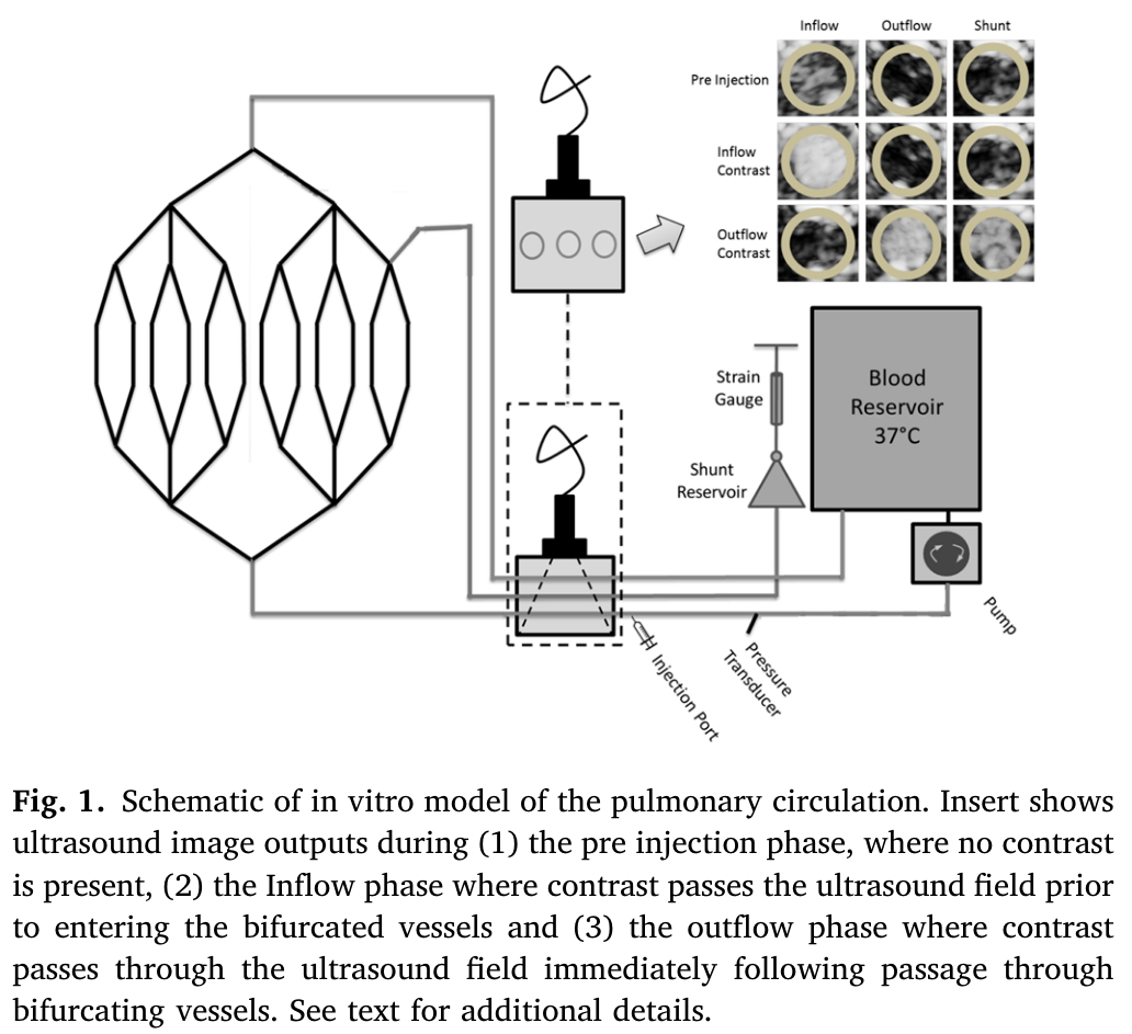 Quantification of shunt fraction using contrast ultrasound and ...